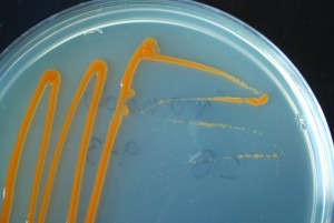 Kirrobacter mercurialis