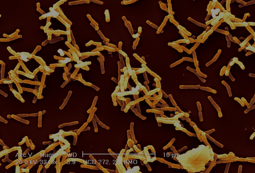 Colorized scanning electron micrograph of Bifidobacteria