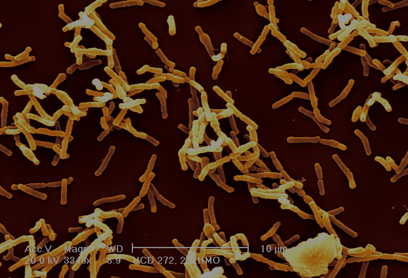 Палочка бифидобактерии. Bifidobacterium bifidum в микроскопе. Бифидум бактерии микроскопия. Bifidobacterium bifidum. Bifidobacterium микроскоп.