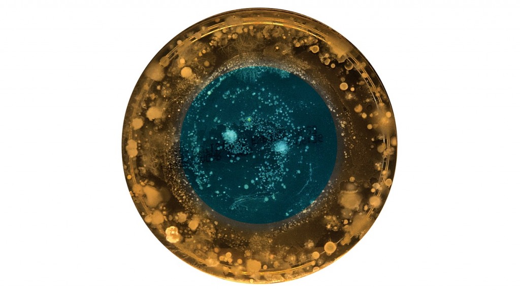 Belly button bacterial culture from Celine in Cornwall, 2015. Portrait by Joana Ricou.