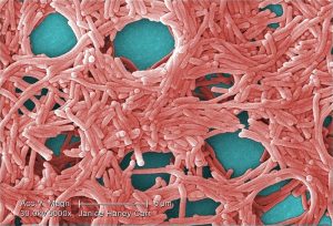 Colorized scanning electron micrograph (SEM) with moderately-high magnification of 5000X, depicting a large grouping of Gram-negative Legionella pneumophila bacteria. Photo credit: Janice Haney Carr