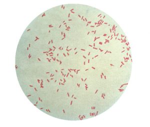 Pseudomonas aeruginosa (public domain, CDC PHIL)
